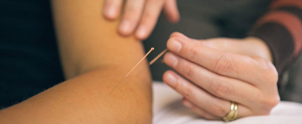 Acupuncture & IMS Clinic | Richmond Steveston Physiotherapy