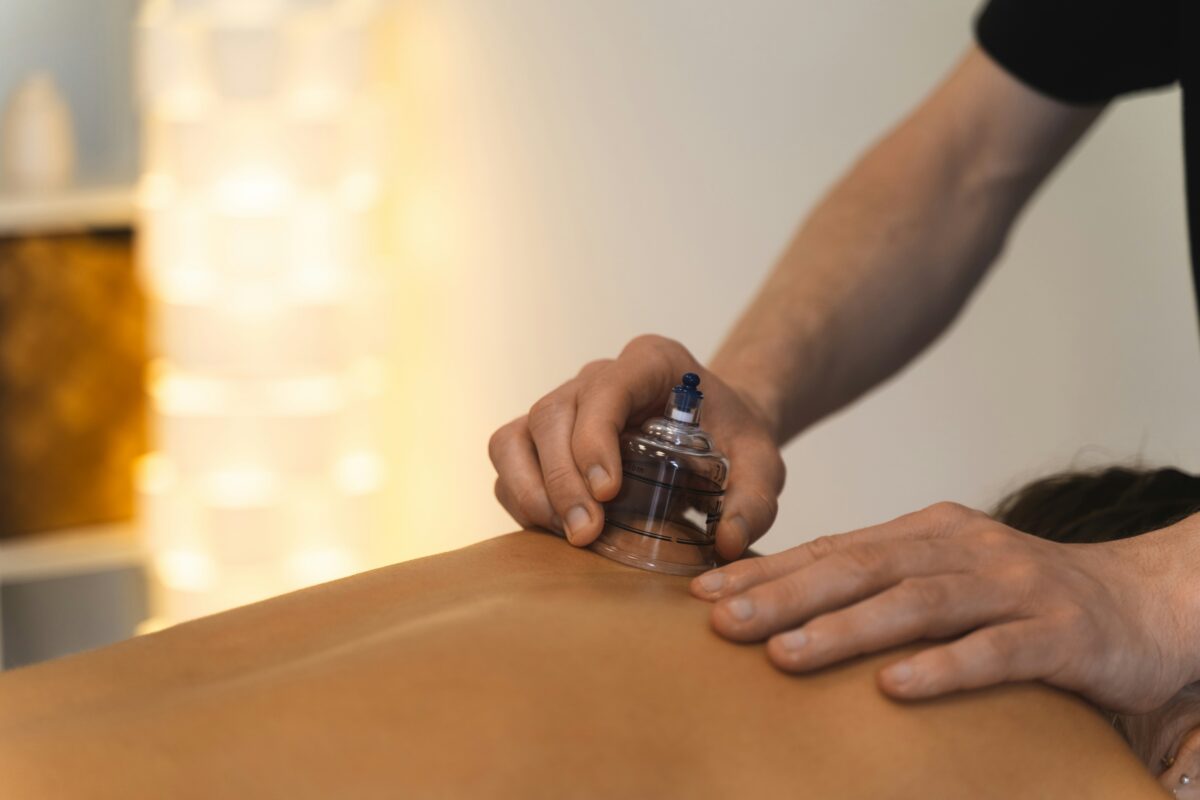 what is cupping